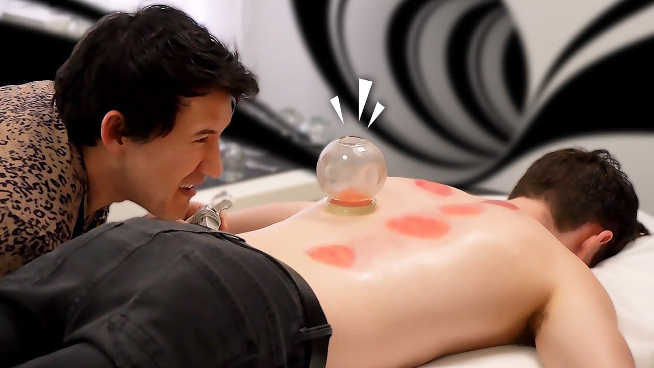 083 - Professional Fire Cupping (Going Even Further Beyond)